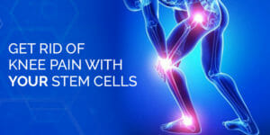 Best stem cell therapy knee pain - StemCures