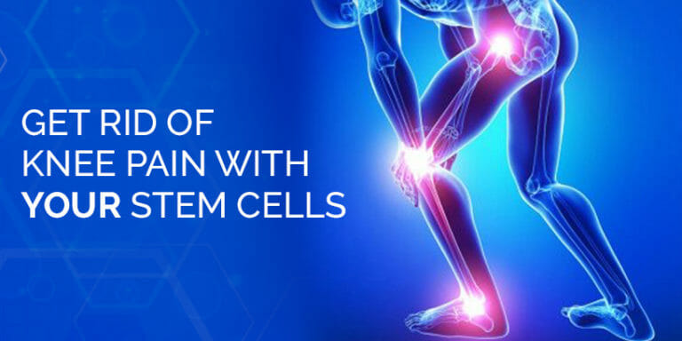 Best Stem Cell Therapy for Knees, Back Pain & Joint pain